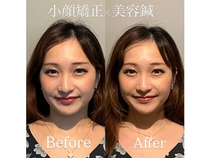 美容鍼灸サロン ユールーム(YOUROOM)の写真