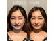 美容鍼灸サロン ユールーム(YOUROOM)の写真