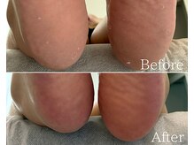 カシェット 広島店(Cachette)/40代女性☆足裏角質ケア90分