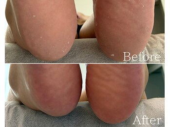 カシェット 広島店(Cachette)/40代女性☆足裏角質ケア90分