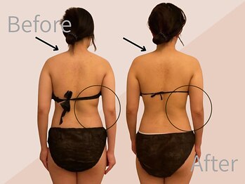 ファミーユ 名古屋店/【ブライダルケア】