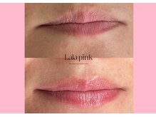 ハーシークレット(Her secret)/ララピンク・メラニンケア