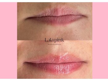 ハーシークレット(Her secret)/ララピンク・メラニンケア