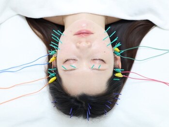 ライフサロン 恵比寿(Life Salon)の写真/【美容鍼×電気パルス】理想の小顔◎たるみ/頬下り/緩み/ホウレイ線ケア◎鍼とパルスで引き締め&引き上げ!