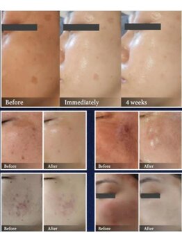 ドルチェビューティーサロン 戸塚安行店(Dolce Beauty Salon)/ダクトピール