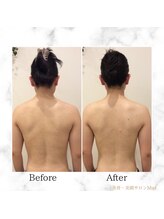 ミエル(Miel)/Before After