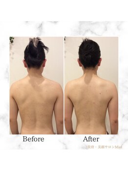 ミエル(Miel)/Before After