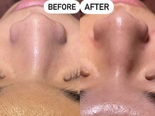 ソーレエルーナ(SOLE e LUNA)/3周年記念メンズクーポン