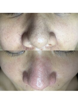 シャイニー(SHINY)/30代女性