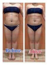 ハンズ鍼灸接骨院小牧院 美容整体ハンズ(美容整体hands)/エステ 痩身