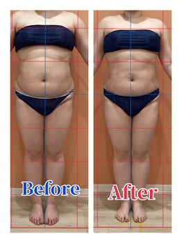 ハンズ鍼灸接骨院小牧院 美容整体ハンズ(美容整体hands)/エステ 痩身