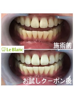 ルブラン 奈良店(Le Blanc)/1科あたり1660円！！