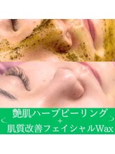 シロ(siro)/ダウンタイム無しピーリング