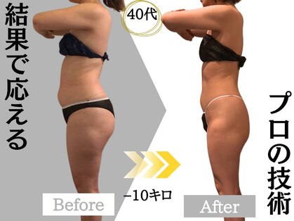 ジャパ Japaの写真