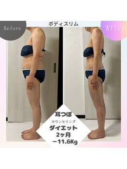 ボディスリム/耳ツボ『2カ月でー11.6kg』