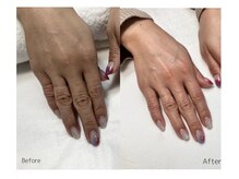 レアノアネイル(Leano'a Nail)/beforeafter