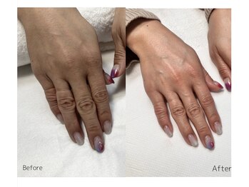 レアノアネイル(Leano'a Nail)/beforeafter