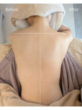 フィル 名駅店(fil)/効果重視の天使の羽ケア