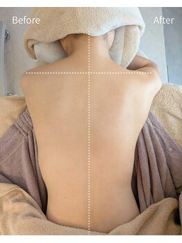 フィル 名駅店(fil)/効果重視の天使の羽ケア