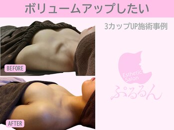 ぷるるんエステ/バストケア/バストアップ/育乳