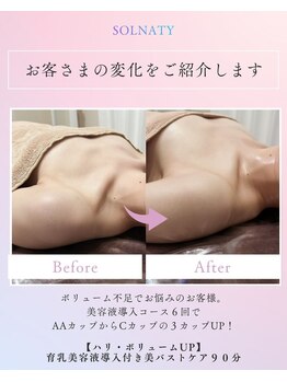 ソルナティ 伊勢原(SOLNATY)/ボリューム不足のお悩みに◎