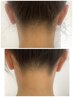 【夏人気!】うなじWAX×光脱毛★まとめ髪/ショートヘアが映える¥4800