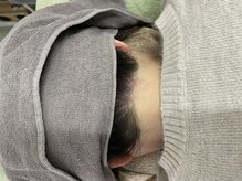 ナノハナ/鹿沼市全身脱毛美容室ナノハナ