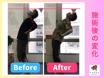 ナオル整体 川越院(NAORU整体)/腰が反れるように【整体/矯正】
