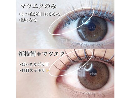 リリー(Lily)の写真