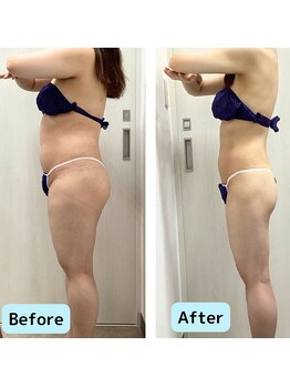 リオンズ 千葉アリオ柏店/姿勢まで変わる!