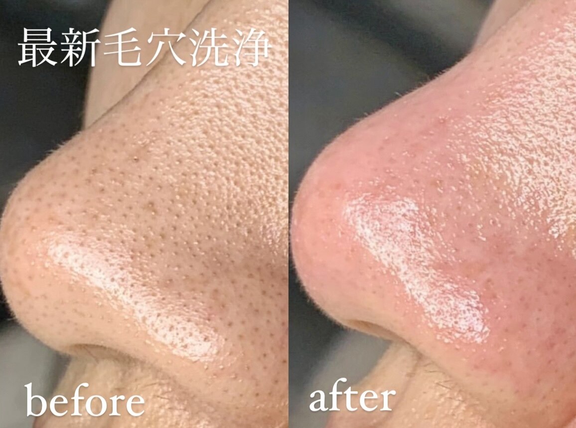 フォト｜エクレ(eclat)｜ホットペッパービューティー