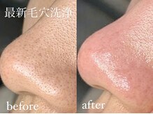 エクレ(eclat)/小さい毛穴も見逃しません！