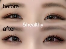 アネロ 千葉東船橋店(anello)/＆healthy140本