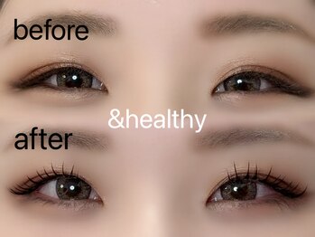 アネロ 千葉東船橋店(anello)/＆healthy140本