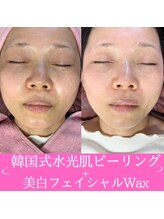 シロ(siro)/水光ピーリング＋肌質改善WAX