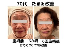 エンジェルエッグ/◆年齢は関係ありません！