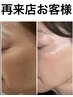 最強小顔【全身オールハンド+グロッティプロケア】美容液深部導入￥33000→