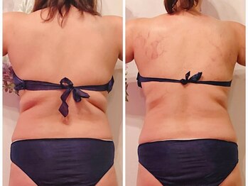 ニコルビー(Nicole Bee)/