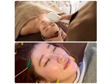ハリラナの雰囲気(本格美容鍼でリフトアップ!光フェイシャルでシミくすみも改善◎)