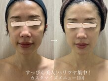 バービーフェイス 恵比寿(Barbie Face)/すっぴんハリ艶集中ケア