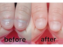 ネイル クロス ラニ 所沢店(Nail×Lani)/深爪矯正/西所沢駅/駅近