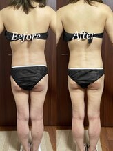 ヴィム(VIM)/ハイパーナイフビフォーアフター