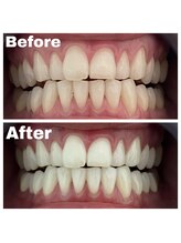 ファストホワイトニング くずは店(FAST WHITENING)/