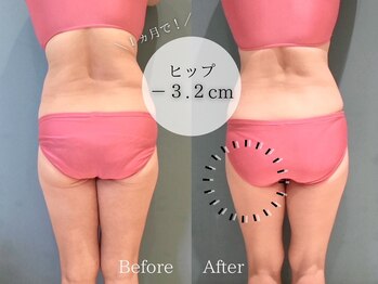 ピュアエステブリアント 銀座店/お客様の結果［銀座/痩身］