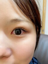 ビヨウシツチャーリー/フラットラッシュ100本