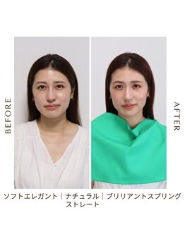 シュアリー(Surely)/トータルコースお客様事例