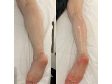 グレアージュ(GLEAGE)/結果重視！むくみ凝り全身リンパ