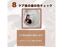 ホワイトニングショップ 津田沼店/【照射の流れ】8