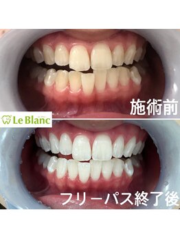 ルブラン 奈良店(Le Blanc)/お得な通い放題で