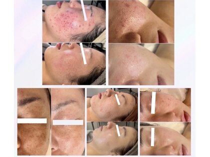 セリンダ(selinda)の写真